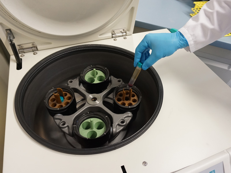Negative Cell Separation