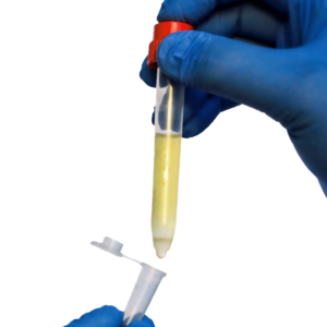 TwinSpin, non-filled, 50 pcs. sterile