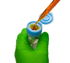 SnapCap Strainer