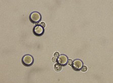 Colon carcinoma Caco-2 cells captured by EpCAM-pluriBead®