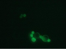 Captured colon carcinoma Caco-2 cells, staining with calcein.
