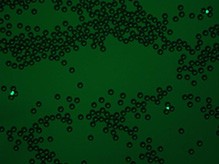 Captured colon carcinoma Caco-2 cells spiked in 30 ml whole blood with 0.5 million EpCAM-pluriBead®