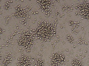 Fluorescent analysis of mature dentritic cells CD14a+