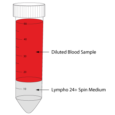 PBMC preparation with Lympho 24+ Spin Medium. The sample material will be overlayed on top of the density medium.