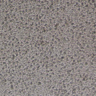 pbmc with platelet contamination