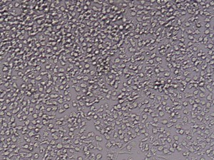 CD14+ cells after isolation in culture+
